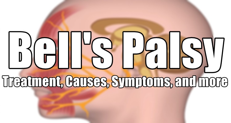 Bell S Palsy Treatment Causes Symptoms And More About This Condition