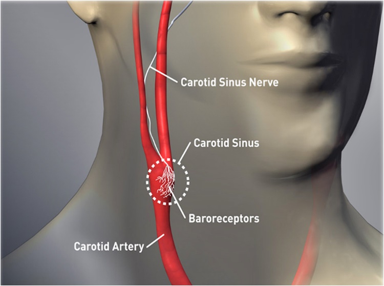 carotid-artery-in-the-neck-why-you-shouldn-t-coil-or-twist-this-part