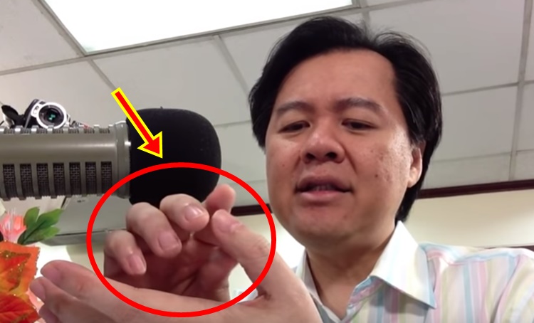 Trigger Finger by Dr. Willie Ong
