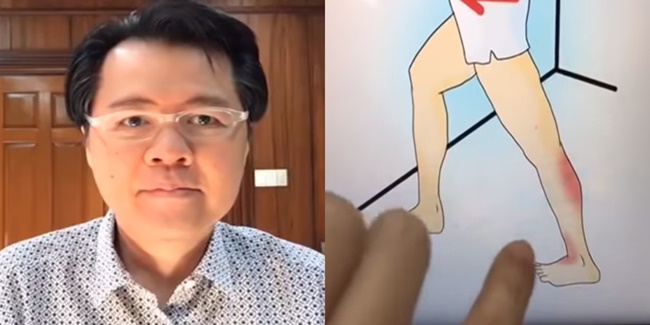 Leg Cramps by Doc Willie Ong