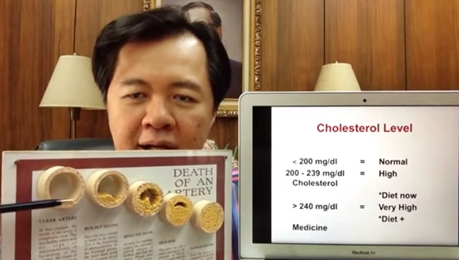 Cholesterol Level by Doc Willie Ong