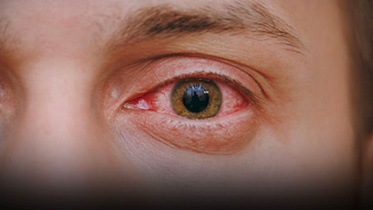 who treats eye diseases
