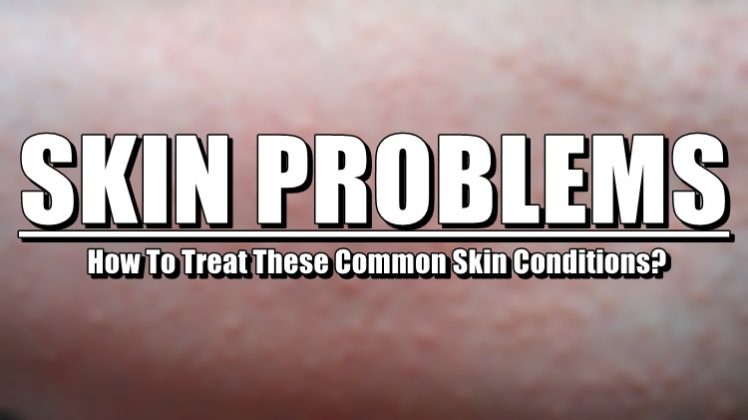 Skin Diseases - A List Of Some Types and How To Treat Them