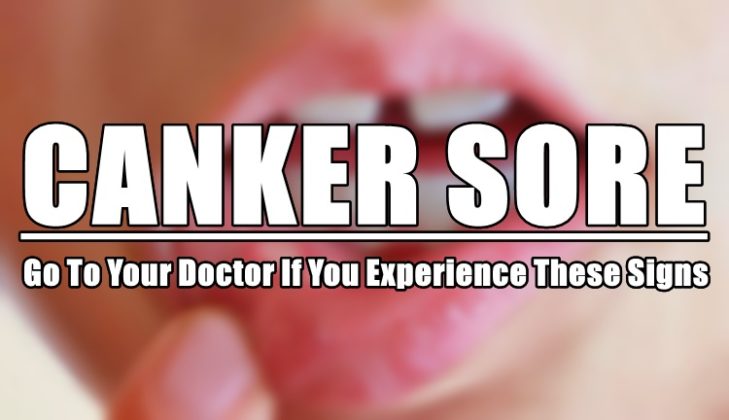 Canker Sore (Singaw): Go To Your Doctor If You Experience These Signs