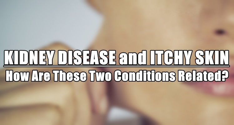 Kidney Disease and Itchy Skin