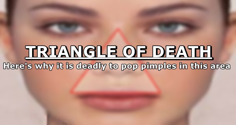 Popping Pimples Triangle Of Death