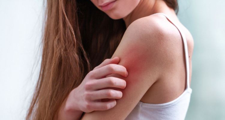 Skin Allergy Types