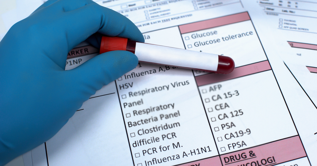 How To Read Lab Blood Test Results Here s A Guide 