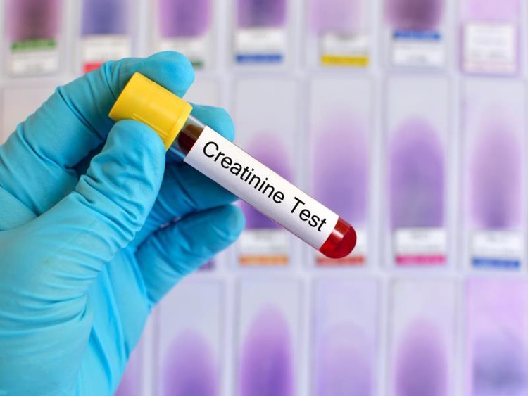 normal range for creatinine