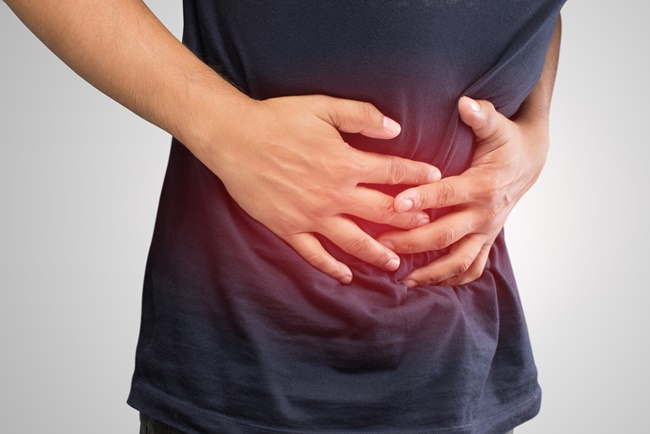 What Is Colon Cancer