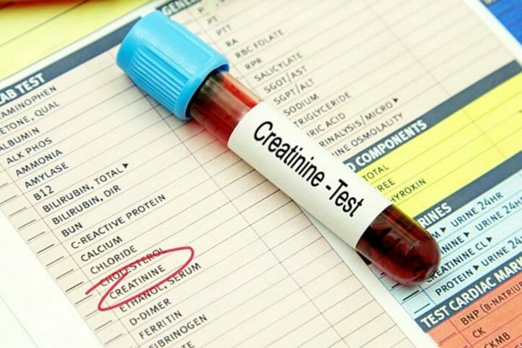 How Do You Know If Your Creatinine Levels are High