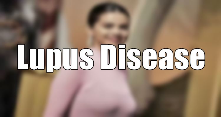 Lupus Disease Types